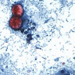 Health Officials Struggle to Pinpoint Source of Expanding Cyclosporiasis Cases