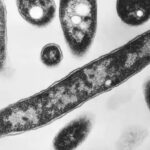 Two Additional Deaths Reported in Manhattan Legionnaires’ Disease Outbreak