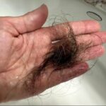 What’s really causing your hair loss? Dermatologist separates fact from fiction
